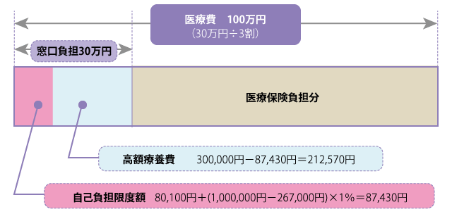 70歳以上・年収約370万円～770万円の方の場合の３割負担の例